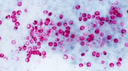 Срок выполнения 5 дней